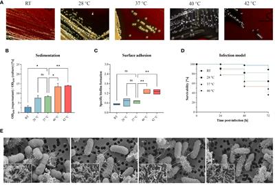 Temperatures above 37°C increase virulence of a convergent Klebsiella pneumoniae sequence type 307 strain